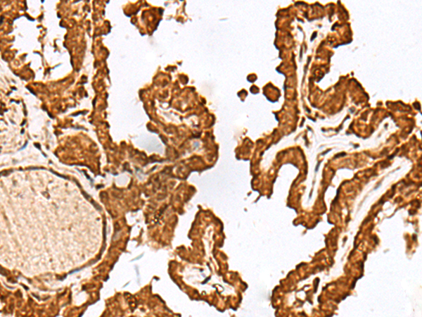 Anti-FAM50A Rabbit Polyclonal Antibody