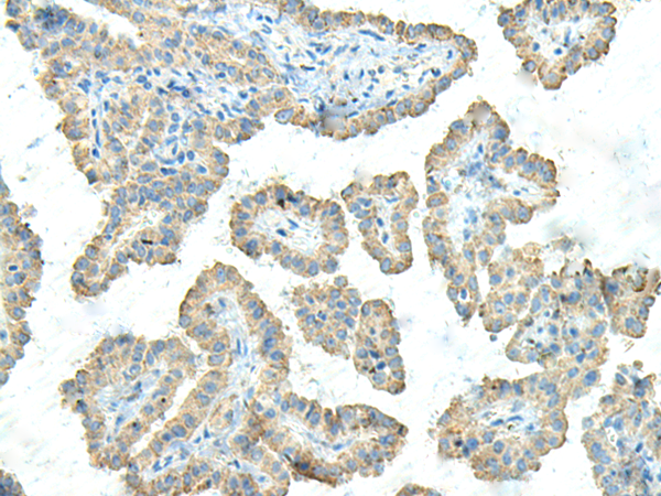 Anti-FCGRT Rabbit Polyclonal Antibody