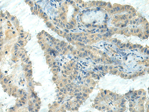 Anti-CTDP1 Rabbit Polyclonal Antibody