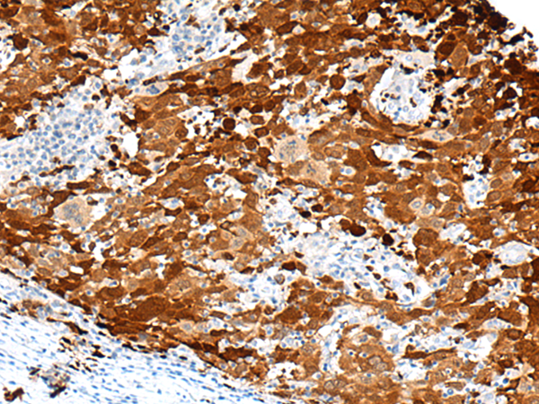 Anti-FGD3 Rabbit Polyclonal Antibody