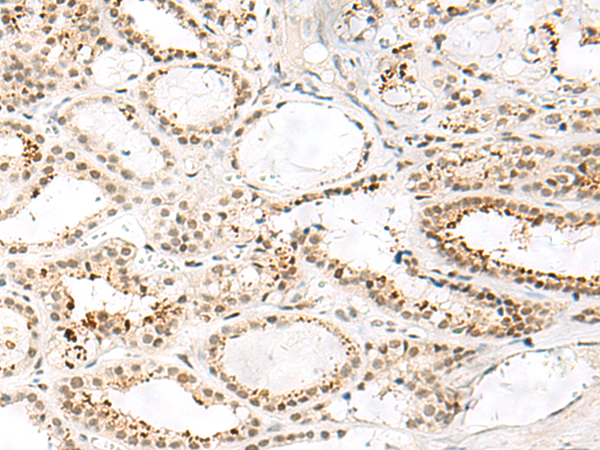 Anti-FKBP5 Rabbit Polyclonal Antibody
