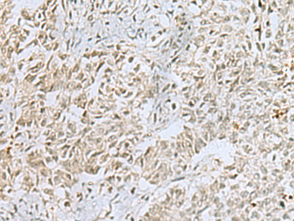 Anti-FOXQ1 Rabbit Polyclonal Antibody
