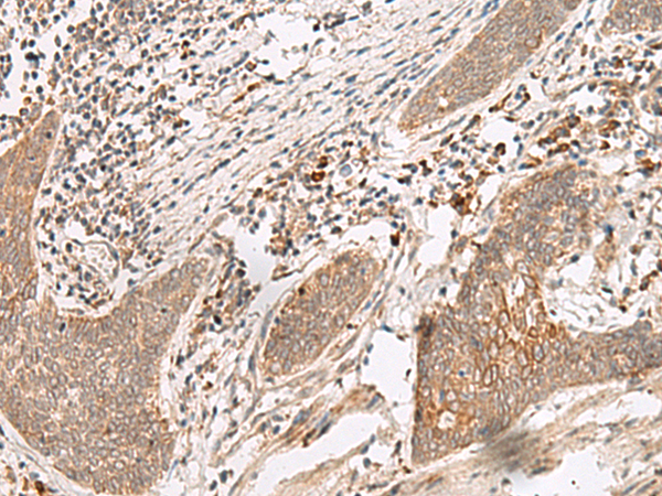 Anti-FUT10 Rabbit Polyclonal Antibody