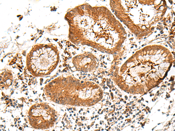Anti-GBGT1 Rabbit Polyclonal Antibody
