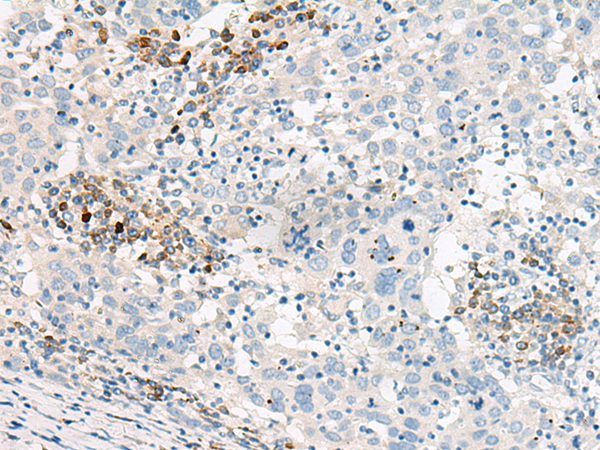 Anti-Guanylate Cyclase Activator 1B Rabbit Polyclonal Antibody