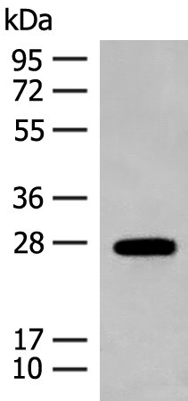 Anti-Guanylate Cyclase Activator 1B Rabbit Polyclonal Antibody