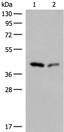 Anti-GIPC1 Rabbit Polyclonal Antibody