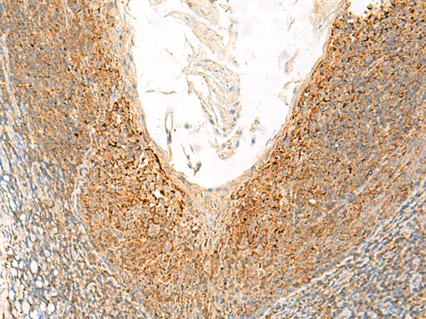 Anti-Glutamate Dehydrogenase 1 Rabbit Polyclonal Antibody