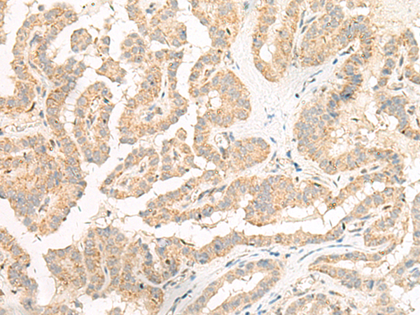 Anti-GP6 Rabbit Polyclonal Antibody