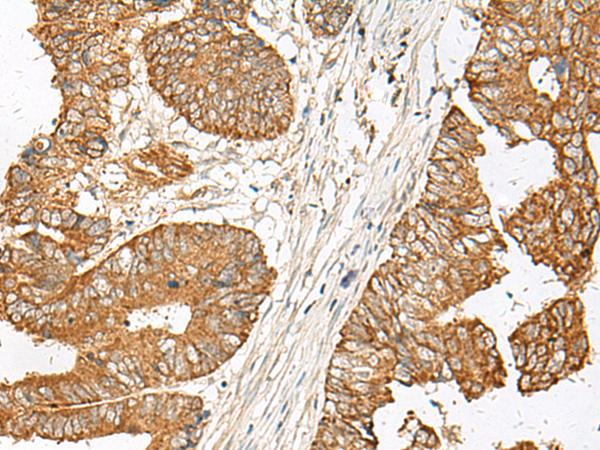 Anti-GNAT1 Rabbit Polyclonal Antibody