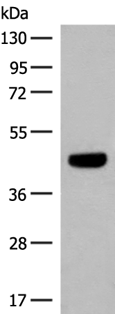 Anti-GNAT1 Rabbit Polyclonal Antibody