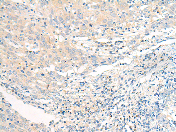Anti-GOLGA3 Rabbit Polyclonal Antibody