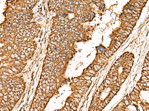 Anti-ATP5ME Rabbit Polyclonal Antibody
