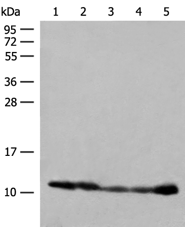 Anti-ATP5ME Rabbit Polyclonal Antibody