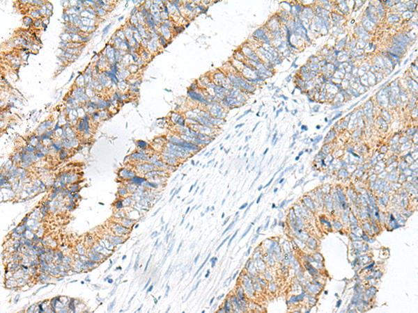 Anti-ROMO1 Rabbit Polyclonal Antibody
