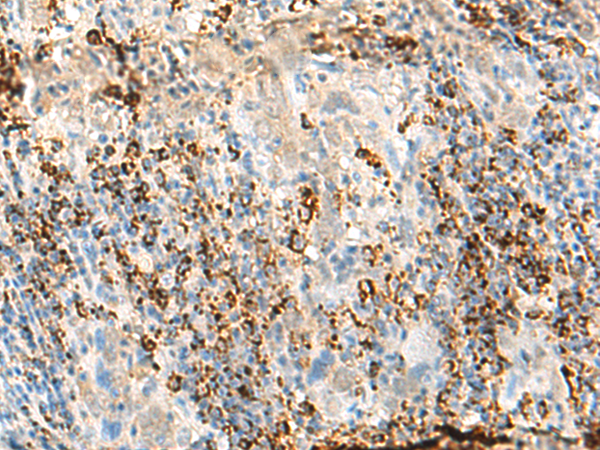Anti-MS4A1 Rabbit Polyclonal Antibody