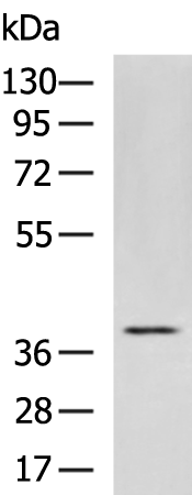 Anti-GPR62 Rabbit Polyclonal Antibody
