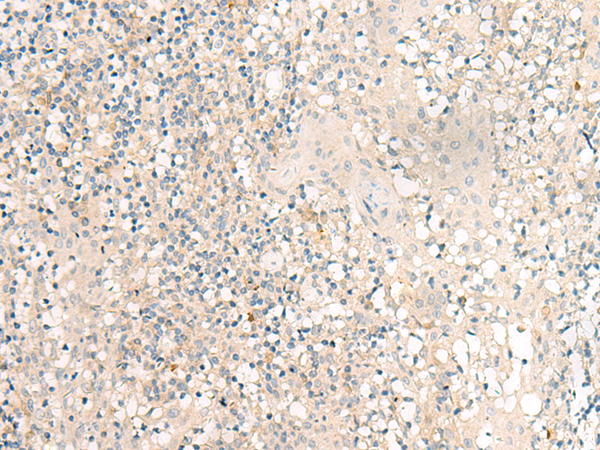 Anti-GPR149 Rabbit Polyclonal Antibody