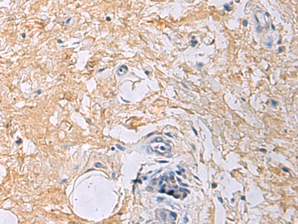 Anti-GRHL1 Rabbit Polyclonal Antibody