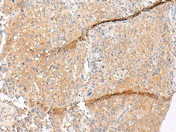 Anti-Guanylate Cyclase Activator 2A Rabbit Polyclonal Antibody