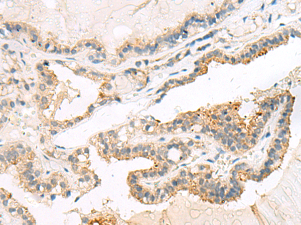 Anti-MOB2 Rabbit Polyclonal Antibody
