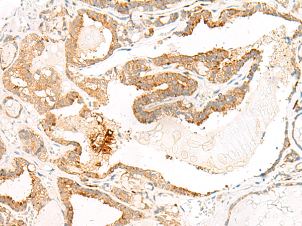 Anti-HEBP1 Rabbit Polyclonal Antibody