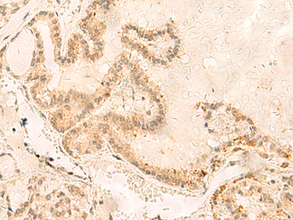 Anti-ZNF85 Rabbit Polyclonal Antibody