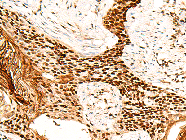 Anti-H1.10 Rabbit Polyclonal Antibody