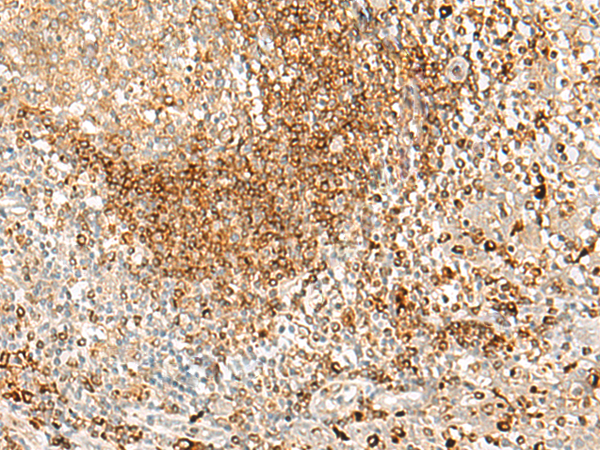 Anti-HLA DPA1 Rabbit Polyclonal Antibody