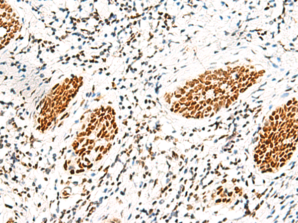 Anti-hnRNP A/B Rabbit Polyclonal Antibody