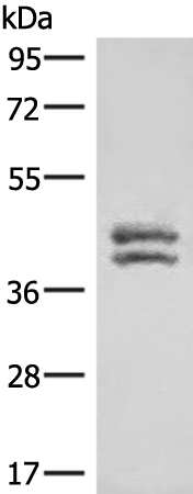 Anti-hnRNP A/B Rabbit Polyclonal Antibody