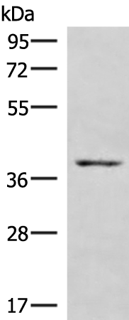 Anti-HOXD9 Rabbit Polyclonal Antibody