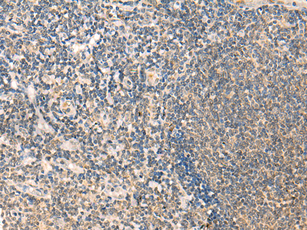 Anti-ELP1 Rabbit Polyclonal Antibody
