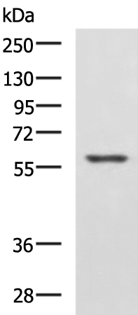 Anti-Interferon lambda Receptor 1 Rabbit Polyclonal Antibody