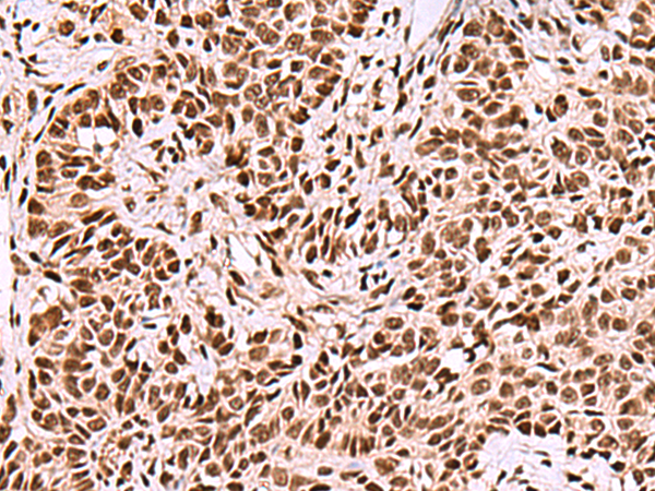 Anti-FOXK2 Rabbit Polyclonal Antibody