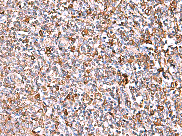 Anti-IP6K1 Rabbit Polyclonal Antibody