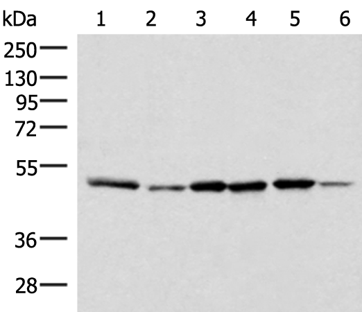 Anti-IP6K1 Rabbit Polyclonal Antibody