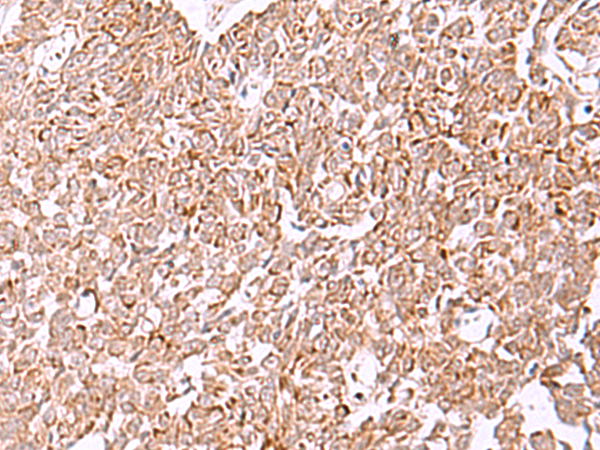 Anti-IRX2 Rabbit Polyclonal Antibody