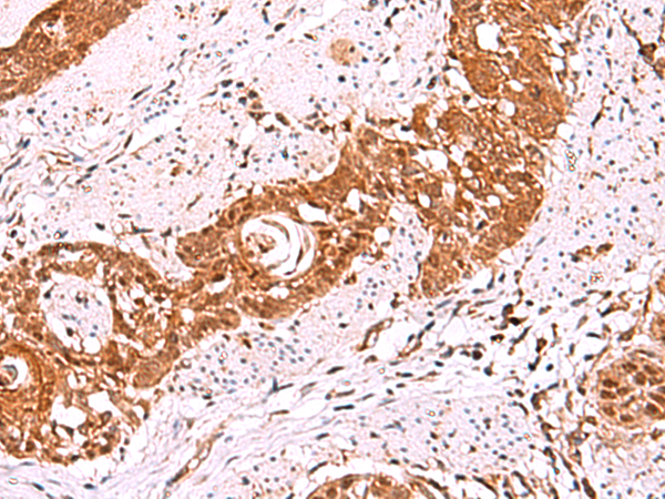 Anti-IRX5 Rabbit Polyclonal Antibody