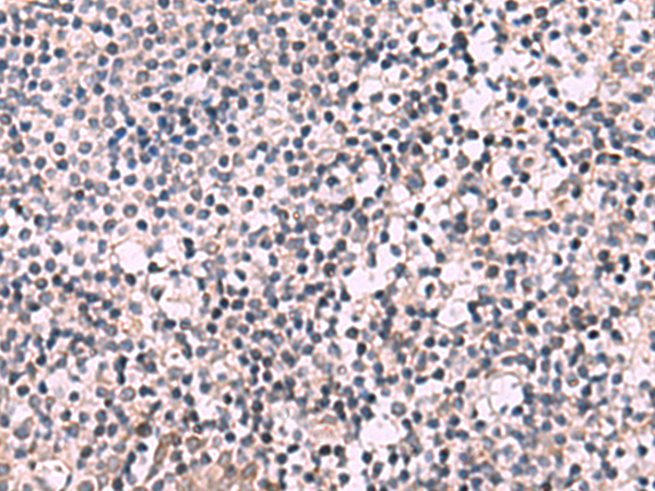 Anti-PEMT Rabbit Polyclonal Antibody