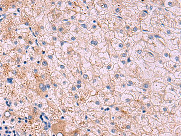Anti-JAM3 Rabbit Polyclonal Antibody