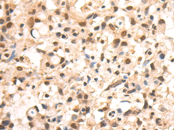 Anti-SOX2 Rabbit Polyclonal Antibody