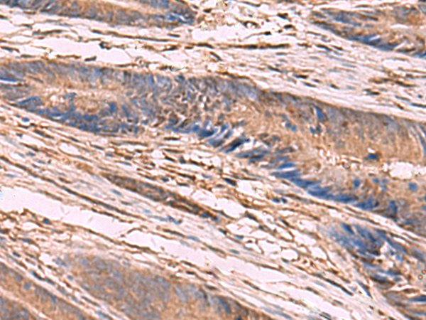 Anti-KCNN2 Rabbit Polyclonal Antibody