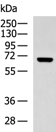 Anti-KCNN2 Rabbit Polyclonal Antibody