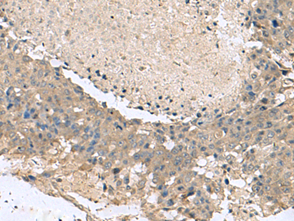 Anti-KCTD7 Rabbit Polyclonal Antibody