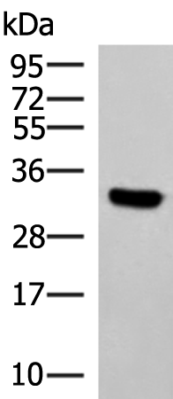 Anti-KCTD7 Rabbit Polyclonal Antibody