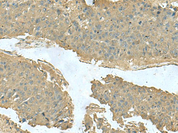 Anti-Keratin 36 Rabbit Polyclonal Antibody