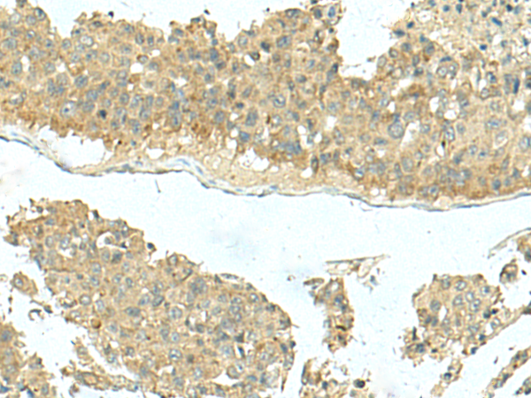 Anti-KIR2DL5A Rabbit Polyclonal Antibody