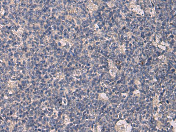 Anti-KRTAP1 1 Rabbit Polyclonal Antibody