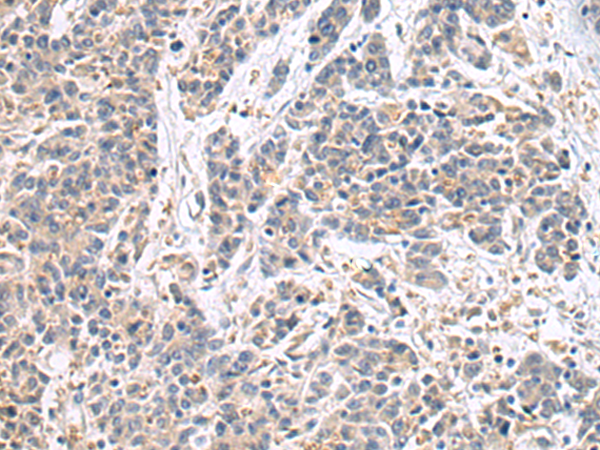 Anti-COX7A2 Rabbit Polyclonal Antibody